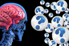 alzheimers-1280x720