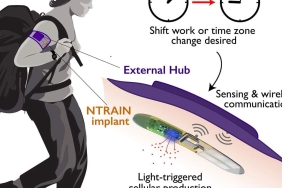 ntrain-implant-1280x720