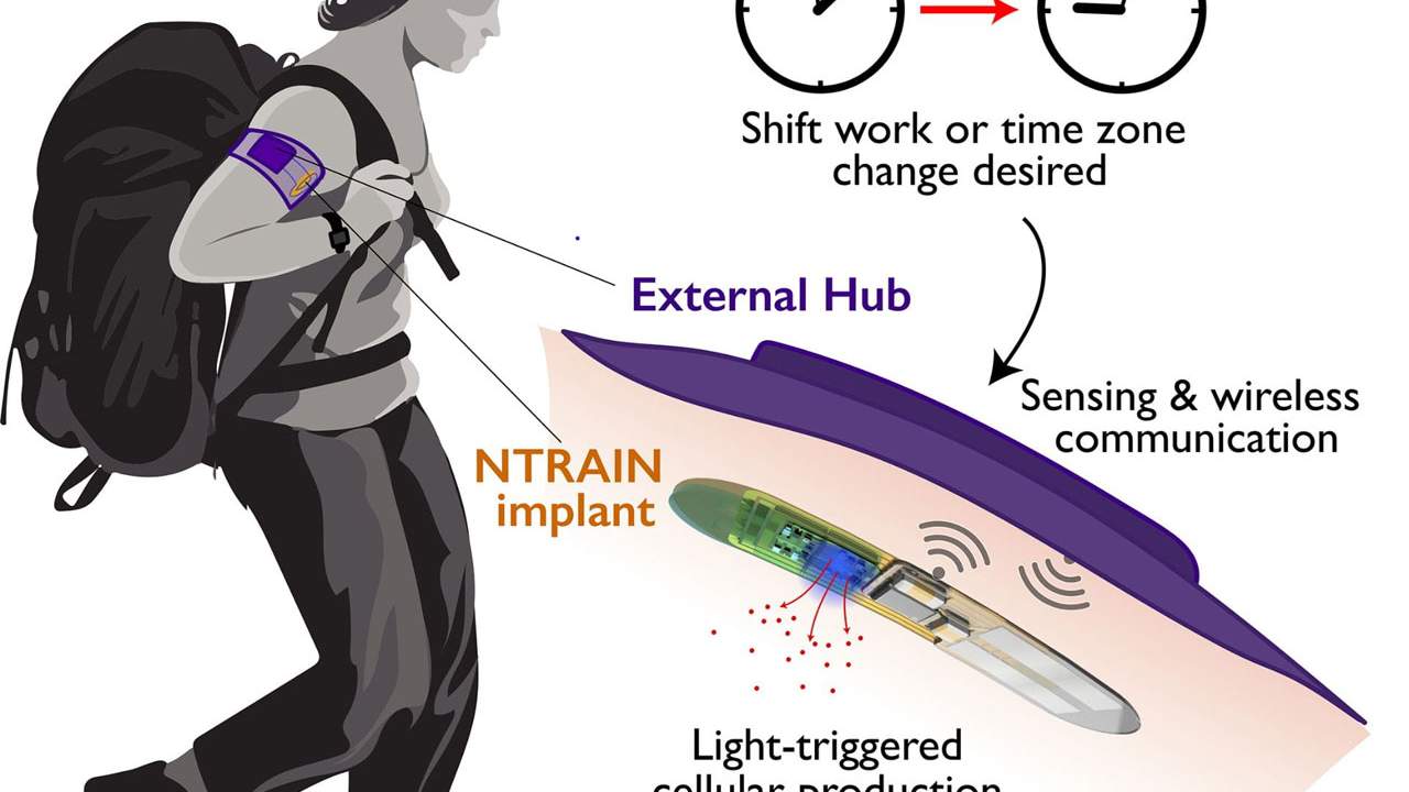 ntrain-implant-1280x720