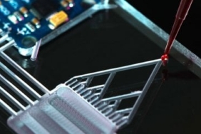 MicrofluidicLabOnChip_600