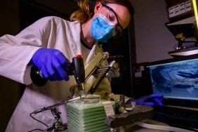 carbon-fiber-brain-implant2-1280x720