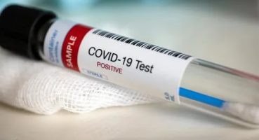 Aşı Olan ve Olmayan COVID-19 Hastalarının Örnek Olacak Tomografi Görüntüleri.