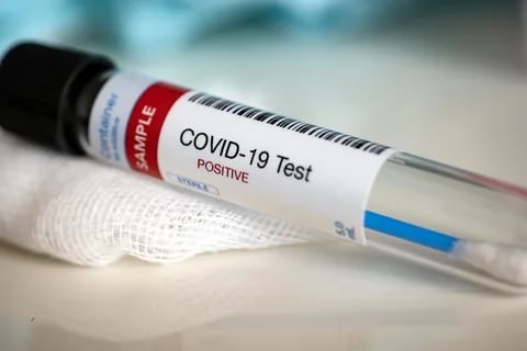 Aşı Olan ve Olmayan COVID-19 Hastalarının Örnek Olacak Tomografi Görüntüleri.