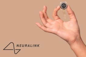 elon-musk-neuralink-ile-milyonlara-beyin-cipi-takacak-dMX51F7P.jpg