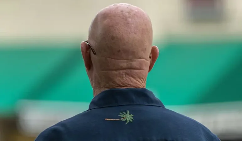 He Shou Wu kelliğe çözüm mü? Yeni bilimsel bulgular